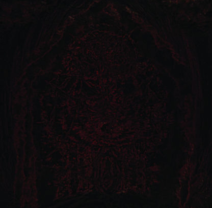 IMPETUOUS RITUAL Blight Upon Martyred Sentience - Vinyl LP (black)